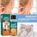 30ml Skin Remover Fast-Acting Skin Remover for Hands and Body Fall Away Quickly Natural & Safe Remover - Buy Online on GoSupps.com