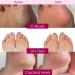 Foot Mask Spa Gift Pack of 8-2X Foot Peeling Mask + 6X Hydrating Foot Masks with Fuzzy Socks for Dry Cracked Heels & Calluses- Exfoliating & Moisturizing Booties for Baby Soft Feet - Foot Spa Gift - Buy Online on GoSupps.com