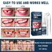 Buy Miioto Provisional Dentures - Temporary Dental Repair Kit for Missing Tooth | International Shipping Available - Buy Online on GoSupps.com
