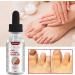  Saiki Toenail Oil for Growth and Strength Nail Repair Solution for Thick Broken & Discolored Nails | Solution for Bleached Damaged Nails 10ml Nail Care Repair Oil Nourish Saiki - Buy Online on GoSupps.com