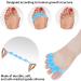 Soft Gel Toe Separator - 2 Pairs | Toe Spacers for Overlapping Toes & Hallux Valgus Correction - White - Buy Online on GoSupps.com