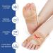 Fantasyon Tailors Bale Toe Corrector | Hallux Valgus Small Toe Pain Relief & Tension Sleeves - Buy Online on GoSupps.com