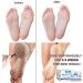 Urea 42% Foot Cream - Cracked Heel Repair & Callus Remover for Dry Skin - Lavender Scent - 100g - Buy Online on GoSupps.com