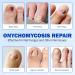 21pcs Patches D'Ongles Fongiques Nettoyage De Champignons D'Ongles Des Orteils Force Suppl Mentaire 8 Heures R Paration D'Ongles De Nuit Soins D'Ongles Sans Effort Et R Paration Pour Ongles Endommag  - Buy Online on GoSupps.com