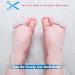 ERSANLI Children's Gel Toe Separator & Bunion Corrector - White, 2 Pcs - Buy Online on GoSupps.com