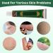 Buy Antis Itching Creme - 4PCs Natural Herbal Cream for Fast Relief of Dry & Itchy Skin - Buy Online on GoSupps.com