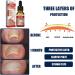 Ingrown Toenail Treatment Oil - Anti Paronychia Relief & Nail Growth Formula - Buy Online on GoSupps.com