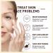 Rice Anti Wrinkle Essence Rice Skin Beauty Essence White Rice Skin Beauty Essence White Rice Skin Care Rice Serum for Face Rice Raw Pulp Essence Natural Rice Face Hydrating Toner - Buy Online on GoSupps.com