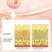 Rice Cream for Skin Turn White Cream of Rice - Face Cream Anti-Aging Moisturizing Nourishing and Hydrating w/Rice Extract for Women - For All Skin Types - Buy Online on GoSupps.com