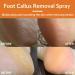 Tongyend Foot Peeling Spray Foot Callus Removal Spray Foot Peel Spray Instant Foot Peeling Spray Orange Oil Soften& Moisturize Peel-Off Spray for Cracked Rough Dry Skin Foot Care - Buy Online on GoSupps.com