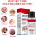 Extra Strong Fungal Nail Treatment 20ml - Premium Toenail and Fingernail Fungus Eliminator - Anti-Fungal Repair and Strengthening - 1 PCS - Buy Online on GoSupps.com