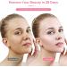 2023 New Microcurrent Face Lift Device - Skin Tightening Rejuvenation Spa for Facial Wrinkle Remover, USB Powered - White - Buy Online on GoSupps.com