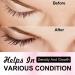 Lash Serum for Eyelash & Eyebrow Growth - Advanced Formula for Longer Fuller Thicker Lashes | Fast International Shipping - Buy Online on GoSupps.com