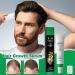  G n rique Hair Growth Oil | Organic Hair Serum | Natural Hair Care for Men & Women | 30ml 3.5x1.3x13.5cm 36.5g Moisturizes Scalp Prevents Breakage and Loss - Buy Online on GoSupps.com
