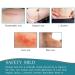 Silicone Scar Sheets 1.6x60 Roll - Professional Scar Tape for C-Section, Burn, Acne - 1.5m Roll - Buy Online on GoSupps.com