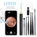 Ear Wax Removal Tool Camera  Smart Visual Ear Cleaner  1080P FHD Wireless Ear Otoscope with LED  IP67 Waterproof WiFi Ear Cleaning Kit with 7 Ear Pick for iPhone  iPad  Smart Phone