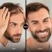Shake Over Vegan Scatter Hair - Zinc-Enriched High-Quality Bulk Hair Medium Brown (12g) - Eco-Friendly Made in Europe - Buy Online on GoSupps.com
