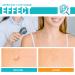 Skin Tag Remover Patches Set (72 PC) & Cream | Natural Ingredients for Safe & Effective Skin Tag Removal with No Pain - Buy Online on GoSupps.com