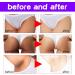 Whitening Cream Whitening Cream Whitening Cream Whitening Cream Whitening Cream For Primary Parts Armpit Whitening Cream Whitening Cream (2) - Buy Online on GoSupps.com
