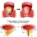 2023 New Best Heca Natural Herbal Strength Hemorrhoid Capsules Natural Hemorrhoid Relief Capsules Pain Or Discomfort Fast Helps Relieve Itching Burning (2 Box) - Buy Online on GoSupps.com