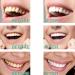 4Pcs Vous Toothpaste Glamcor Whitening Toothpaste Glamvora Triple Whitening Niacinamide Toothpaste Fresh Breath Remove Tooth Stains (Probiotic) 1 Count (Pack of 4) - Buy Online on GoSupps.com