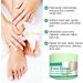 Foot Cream for Very Dry Feet Cracked Heel Repair Cream Callus Remover Foot Moisturiser Hard Skin Remover Foot Soften & Smooths Feet Deep Moisturizing Nourishing Formula for Feet Care - Buy Online on GoSupps.com