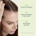 Ren Furterer - VITALFAN - Reactional Hair Thinning - Dietary Supplement Sudden Temporary Thinning Hair- 30 caps - Buy Online on GoSupps.com