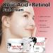 Kojic Acid Face Cream with Retinol - Skincare Moisturiser Face Women - Kojic Acid Lighten Spots and Improve Dull Skin - Moisturiser Plump Restore Elasticity Reduce Dryness - Anti Aging Face Cream - Buy Online on GoSupps.com