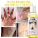 Extra Strong Peeling Oil for Dark Skin | Yellow Exfoliating Solution for Hand & Feet | Chemical Peel for Face | 110ML | Ships Internationally - Buy Online on GoSupps.com