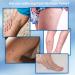 WosAna Varicose Vein Cream - Natural Spider Veins Treatment for Improved Leg Appearance and Circulation - Buy Online on GoSupps.com