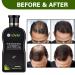 Dexe Hair Growth Shampoo - Anti-Hair Loss Treatment for Thinning Hair - Organic Ingredients - Repair Damaged Scalp - Men & Women - 200ml - Buy Online on GoSupps.com