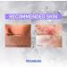 TROIAREUKE ACSEN CICA SEN Toner - Hypoallergenic Ultra-Soothing for Sensitive Skin | High CICA Concentrate - International Shipping Available - Buy Online on GoSupps.com