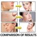 Anti-Aging Bee Venom Facial Gel Moisturizer | Anti-Wrinkle Cream with Collagen & Hyaluronic Acid | Firming Face Cream for Fine Lines - Buy Online on GoSupps.com