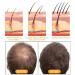 Ginaday Instant Ginger Hair Regrowth Shampoo 17.6oz - Promotes Hair Growth, Prevents Hair Loss - Ginger Hair Care Shampoo - 1pcs - Buy Online on GoSupps.com