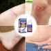 Effective Scar Cream for Old & New Scars | Smooth Skin Care - 30 ml | International Shipping Available - Buy Online on GoSupps.com