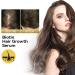 Tongyend Castir Oil Hair Growth Oil Castir Essential Oil Ginger Oil for Hair Growth Rosemary Hair Growth Oil Improve Hair Loss & Nourishes for Women Men-50ML - Buy Online on GoSupps.com