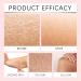 Soft 7 Turmeric Oil Veetgold Body Oil Veetgold Turmeric Oil Veetgold Turmeric Body Oil Soft 7 Body Oils Turmeric Body Oil for Face & Body Moisturizer (. Rose 100ml) - Buy Online on GoSupps.com