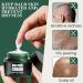 Baume Apr s-rasage et Huile de Soin du Cuir Chevelu Cr me de Soin du Cuir Chevelu Soins Contre la Calvitie Soins Anti-irritations et Rasage 50g+20ml Cr me contre la calvitie + Essence contre la calvitie 25 g (Lot de 2) - Buy Online on GoSupps.com