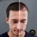 CROWN Hair Fibers for Thinning Hair - Dark Brown 0.87oz/25g Bottle | Natural Keratin Hair Loss Concealer for Men & Women - Buy Online on GoSupps.com