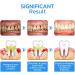 Buy Gum Instant Treatment Gel & Teeth Whitening Essence - 5 PCS - Soothing & Repairing Gum Therapy - Buy Online on GoSupps.com