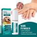 Anti-Fungal Nail Treatment Kit with Nail Clippers & Glass Nail File - Natural Ingrown Toenail Correction & Fungal Nail Repair - 2 in 1 Nail Care Solution - Buy Online on GoSupps.com