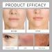 Lot de 2 cr mes anti-rides pour le visage - Hydratant en profondeur pour la peau - Am liore le contour - Am liore les rides profondes - Augmente le bourdonnement de la peau - Pour la journ e et - Buy Online on GoSupps.com