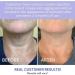 Tighten Neck Firming Cream Tighten And Lift Neck Cream Anti-Aging Neck Cream for Tightening Tighten and Lift Neck Cream Tightening Moisturizer for Neck Eliminates Wrinkles & Hydrating-Men & Women - Buy Online on GoSupps.com