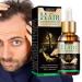 fanelod Hair Growth for Women - Natural Ginger Hair Growth Serums 20ML, Biotin Hair Growth - Nourishing Ginger
