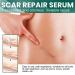 Scar Repair Essence - Acne & Dark Spot Remover for All Skin Types (3 pieces) - Buy Online on GoSupps.com