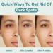 CITYGOO Dark Spot Remover Cream for Face and Body - Natural Ingredients for Melasma, Freckles, Sun Spots - 1.7 FL OZ - Buy Online on GoSupps.com