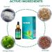 Cyoket Overallgo PureHear Organic Ear Support Elixir - Natural Ear Oil for Ringing Ears and Ear Pain (1pc) - Buy Online on GoSupps.com