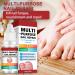 Fungal Nail Treatment Solution - Extra Strong Repair for Toenails & Fingernails - Safe & Effective - 2pcs x 1.00 ml - Buy Online on GoSupps.com