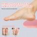 TOVINANNA Foot File Remover Heel Scraper Foot Scrubber Dead Skin Remover Pedicure Foot Buffer for Feet and Cracked Heel - Buy Online on GoSupps.com