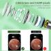 VITCOCO Ear Wax Removal Tool | 1920P HD Ear Cleaner with 6 LED Lights | Visual Ear Camera | Ear Cleaning Kit for iPhone, iPad, Android - Black - Buy Online on GoSupps.com